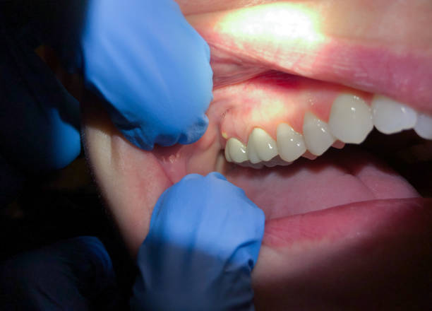 Best Emergency TMJ Treatment in Owensville, IN